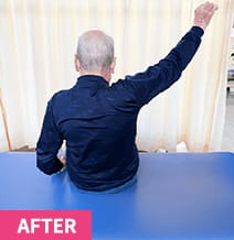 70代男性の肩関節施術後写真 肩関節の可動域が広がり腕がスムーズに上まで上がっている状態